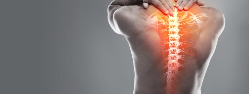 Spine Injury Attorneys In Los Angeles | SFVBA Referral Service