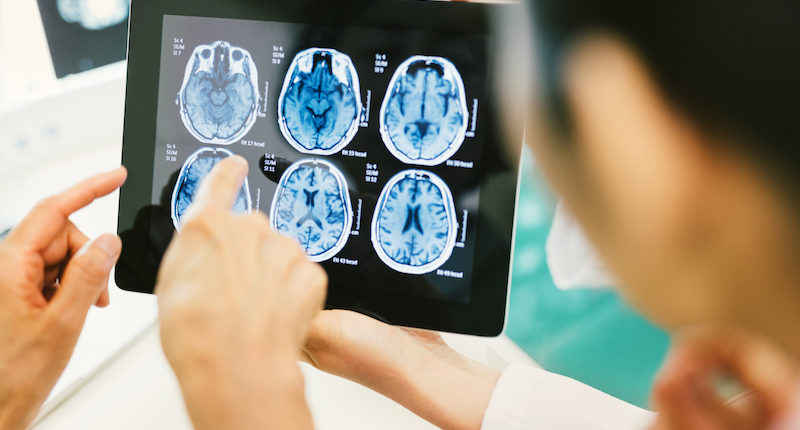 How Can a Traumatic Brain Injury Attorney Help You? | SFVBA Referral